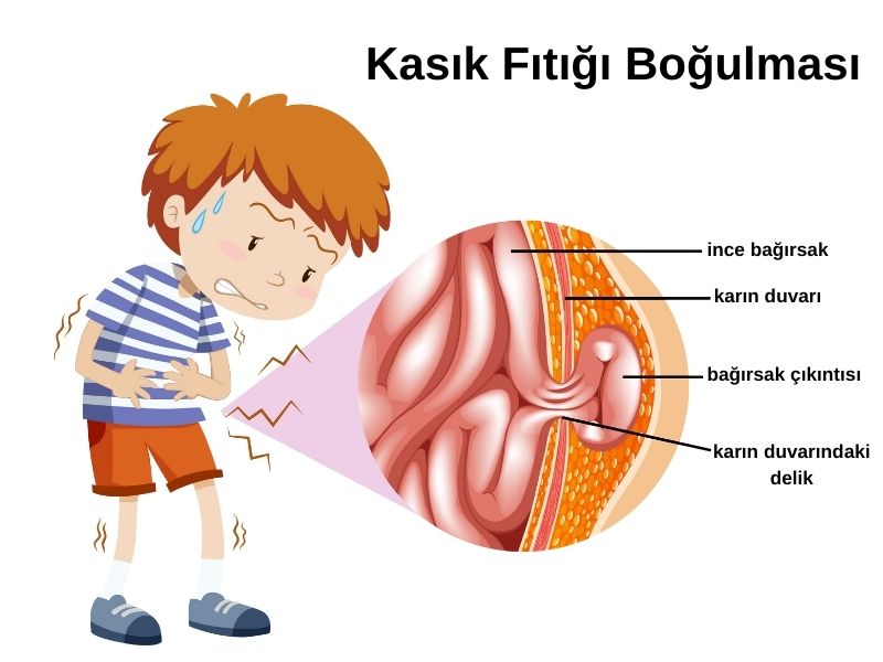 kasik-fitigi-bogulmasi